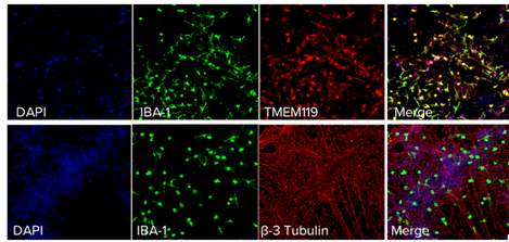 Immunocytochemistry of Human iPSC-derived Microglia co-cultured with Human iPSC-derived cortical neurons reveals microglia specific maker expression TMEM119 and neuronal marker β-3 Tubulin.